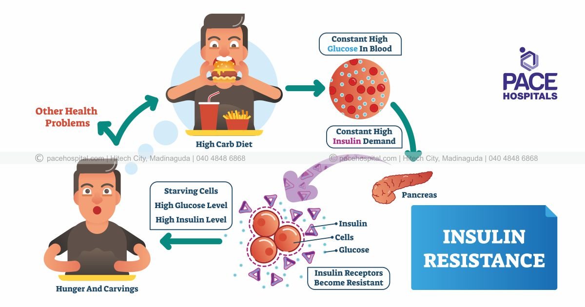 Insulin Resistance a cause of worry for prediabetic