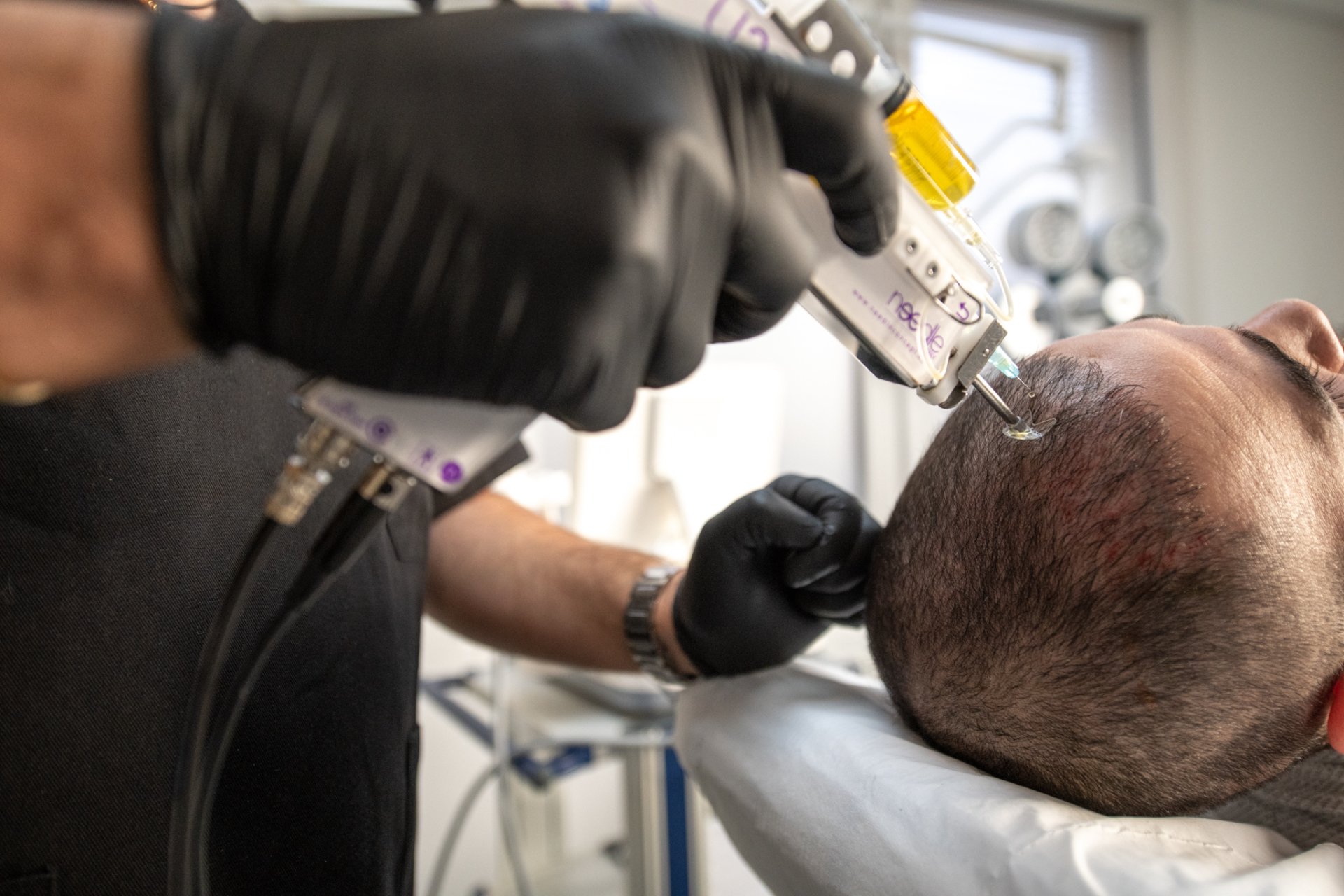 Docteur Christian Fayard medecine esthetique Amiens entre