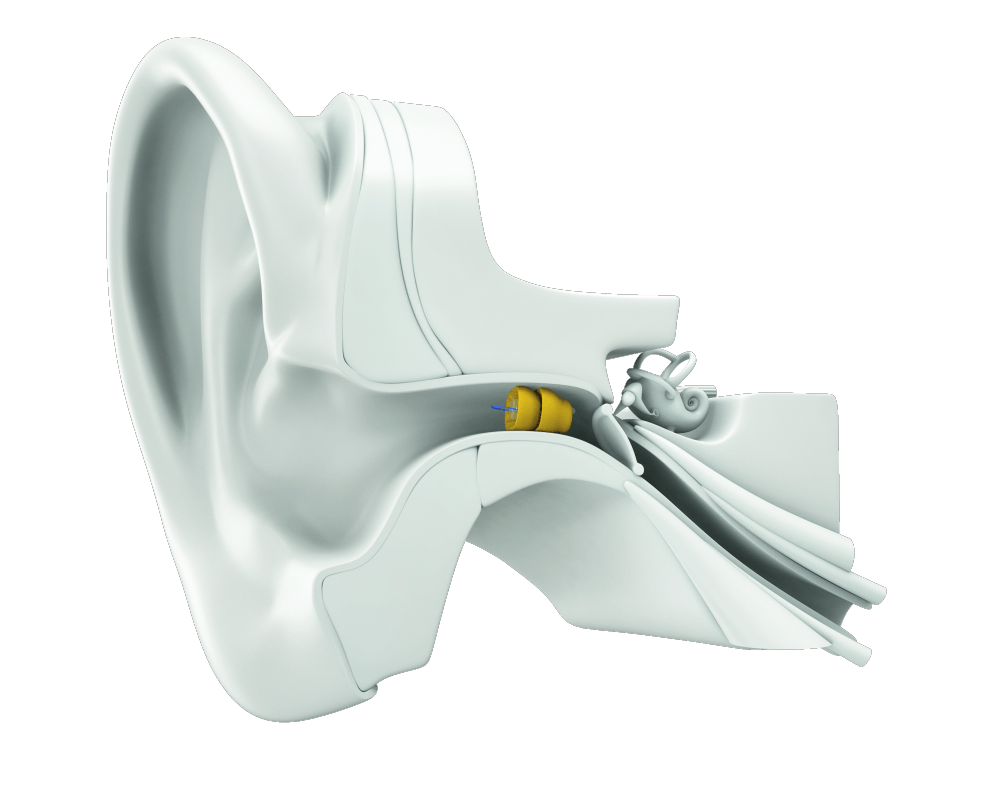 Hearing Aids Edmonton