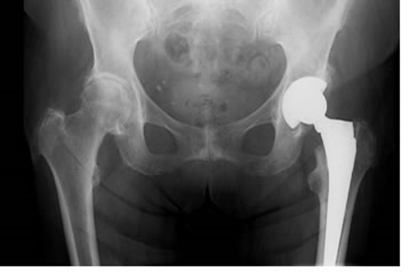 Created for orthopaedic patients by the multdisciplinary team