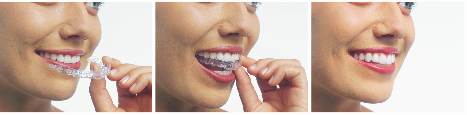 Mia Dental Centre (08) 9206 0058 Wanneroo, Joondalup, Carramar, Tapping