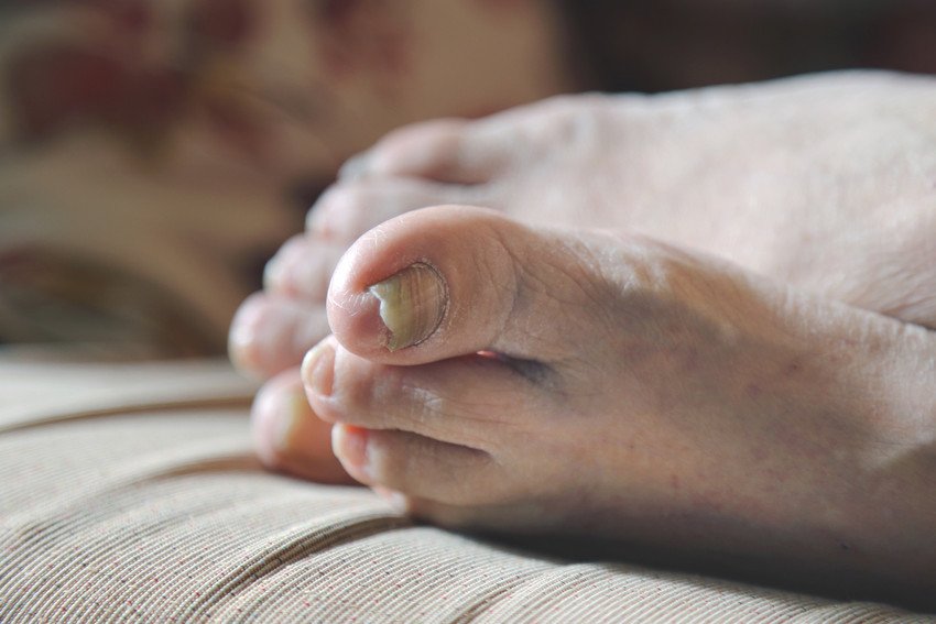 Chiropody &amp; Podiatry Home Visit Chiropodist