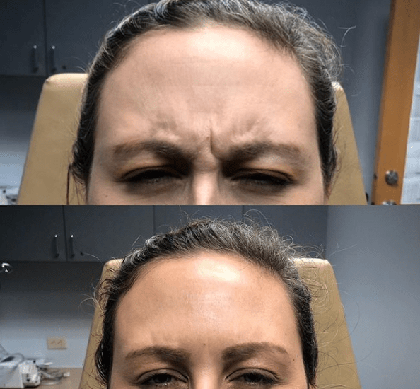 Before and After Cosmetic Surgery San Antonio, TX Alluring Aesthetics