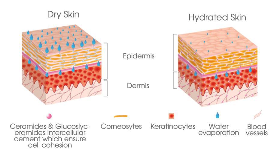 Is That Patch of Dry Skin The "Winter Itch" or Eczema?