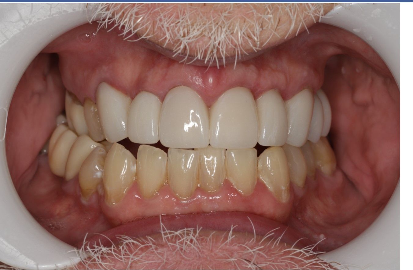 Smile Gallery Top Family Dentist King VA