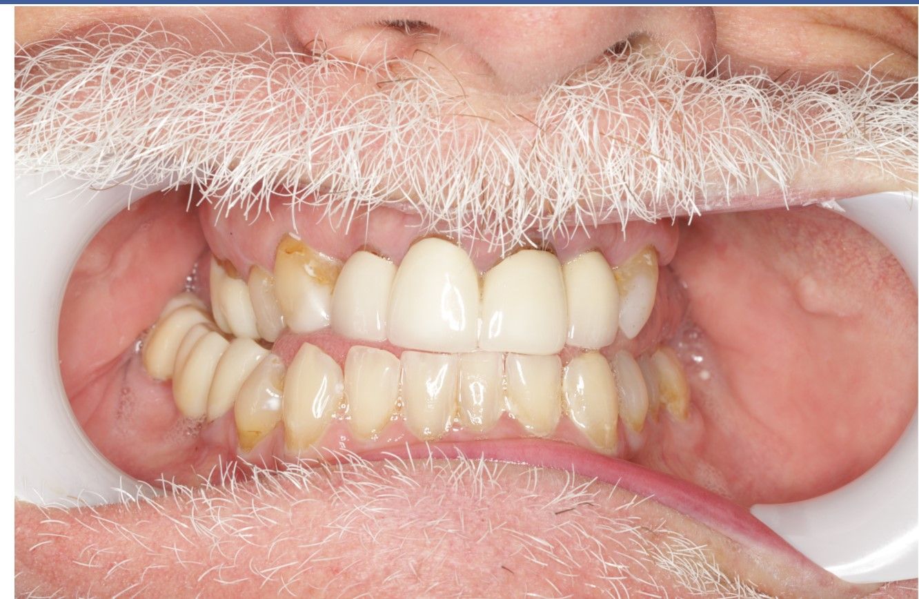 Smile Gallery Top Family Dentist King VA