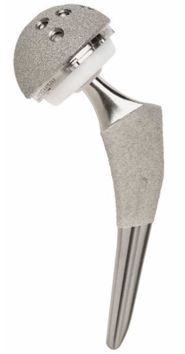 Total Hip Replacement Hip Dr Neil Ferguson Armidale