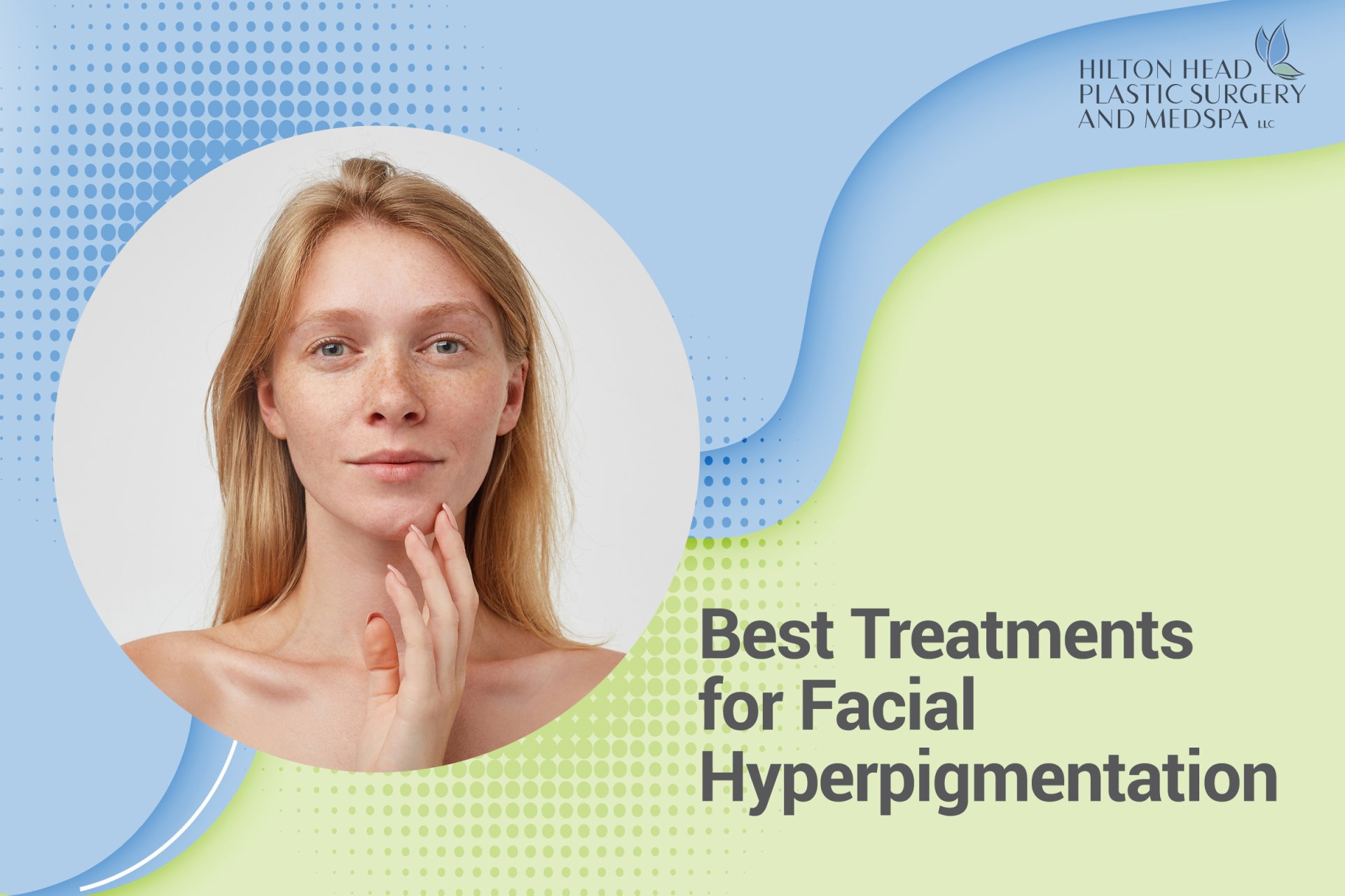 The Best Treatments for Facial Hyperpigmentation