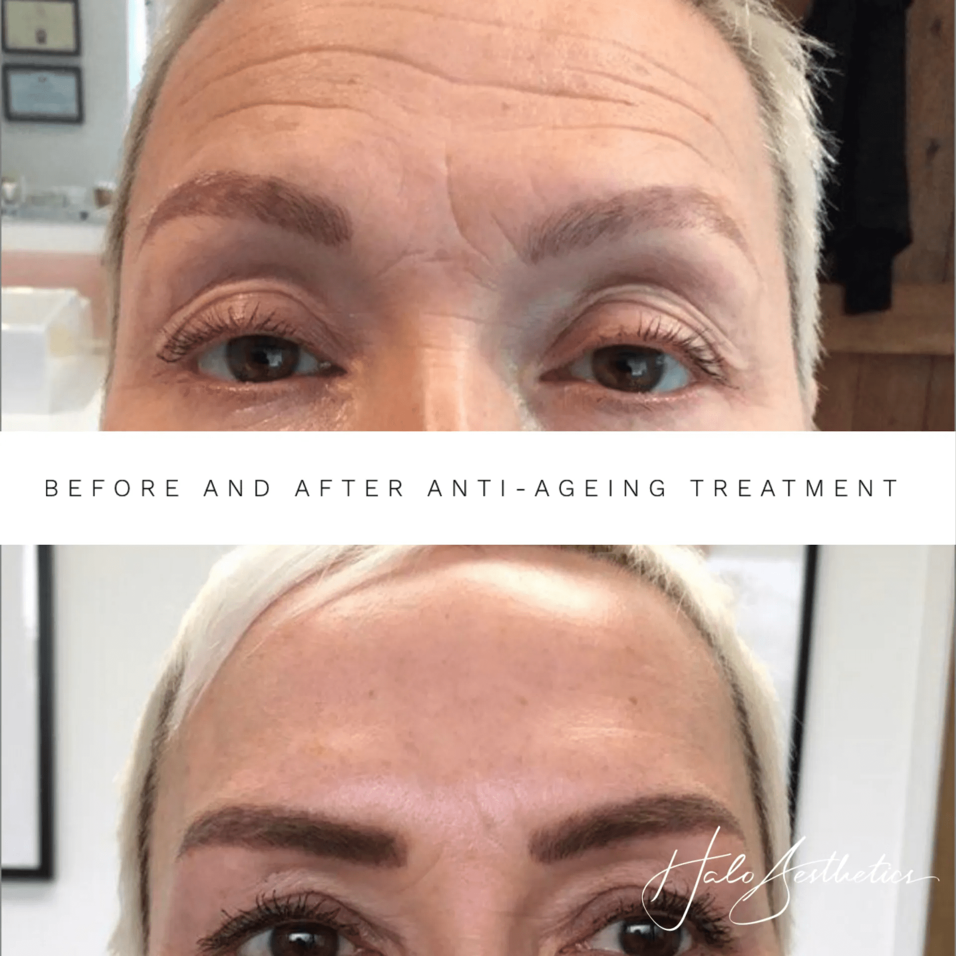 Aesthetics clinic photo guide Milton Keynes