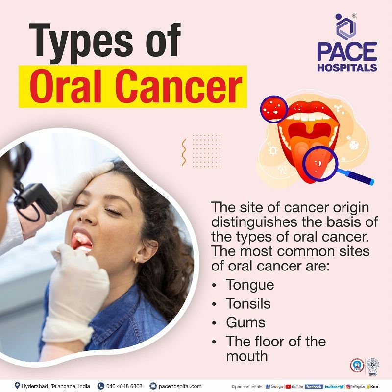 Oral Cancer Symptoms, Causes, Complications & Prevention