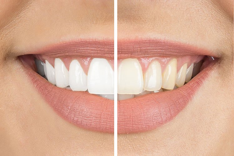 Family & Cosmetic Dentist Land O' Lakes Dental Care