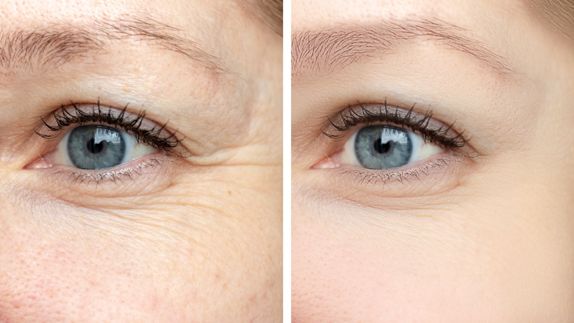 Call Esthetics Scar Reduction