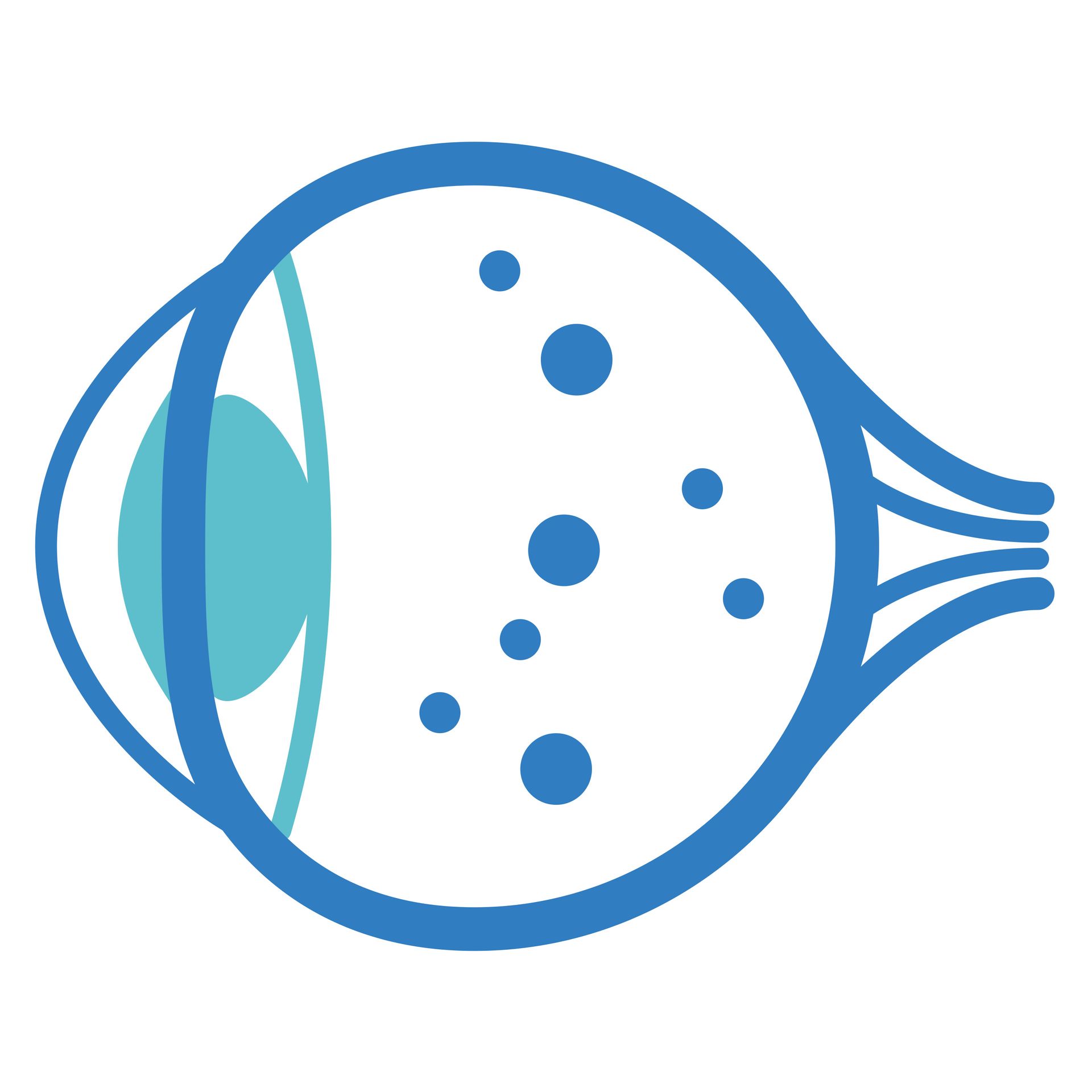 DEALING WITH “EYE FLOATERS”