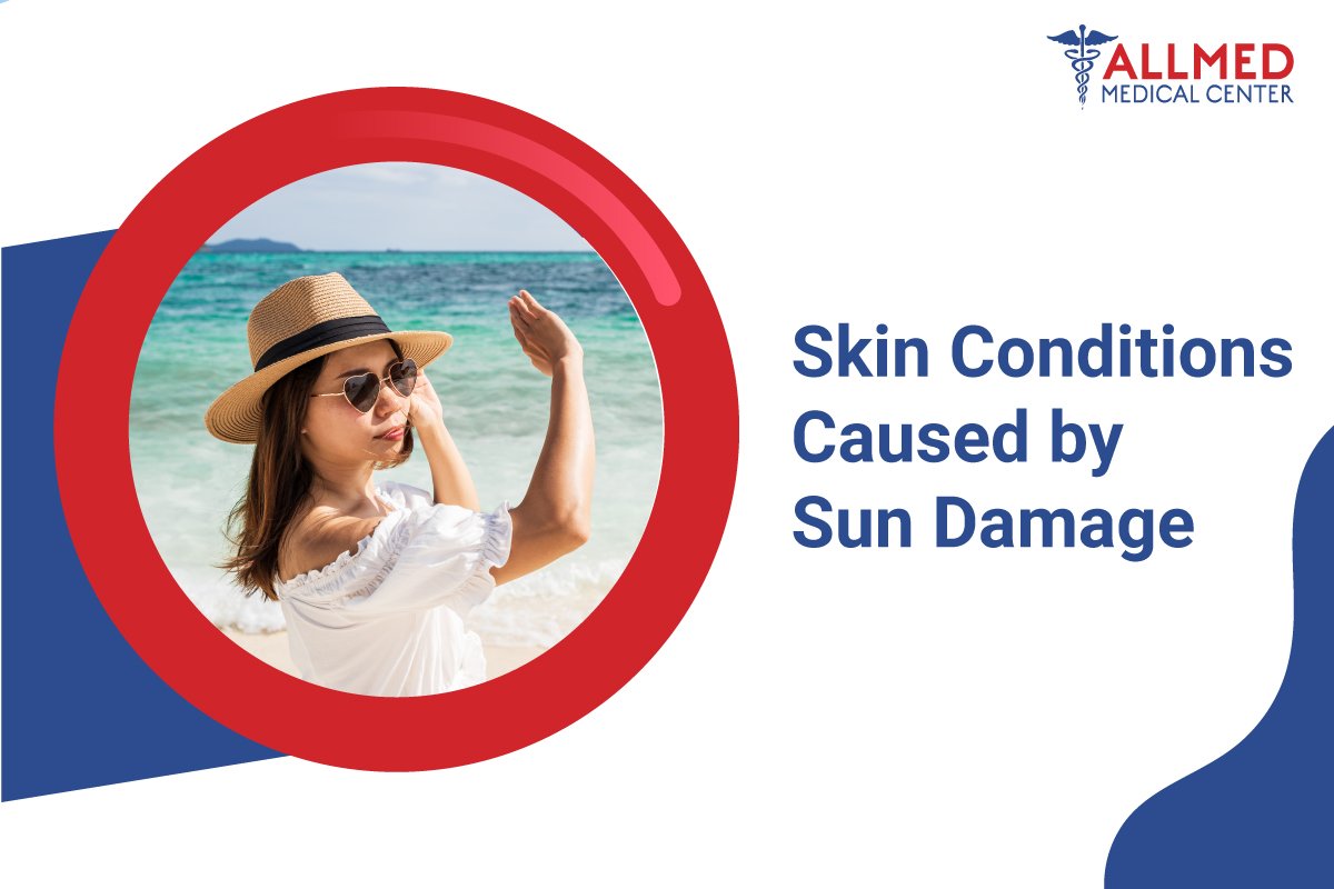 Skin Conditions Caused by Sun Damage AllMed Medical Center