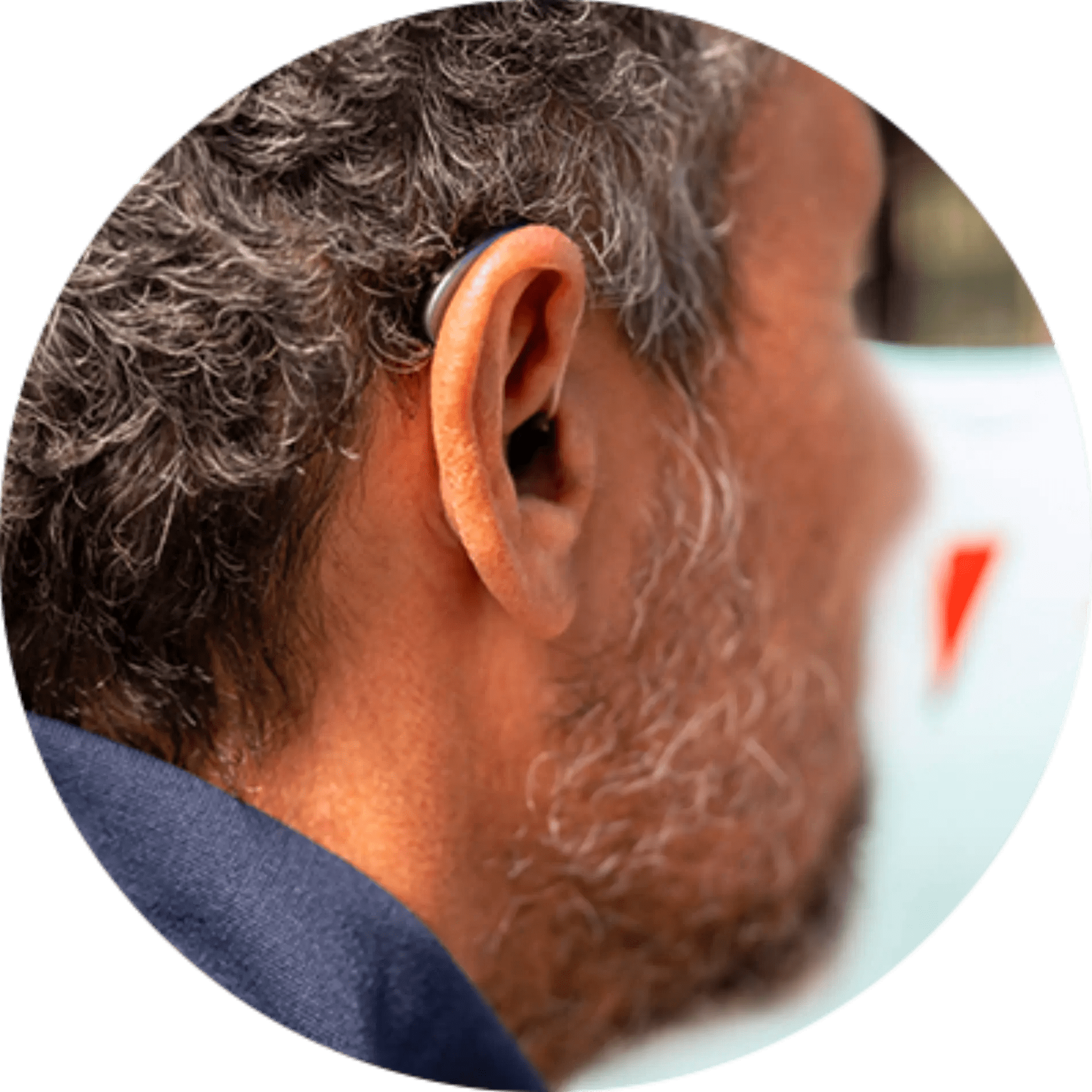 Signia Integrated Xperience Hearing Aid Edmonton