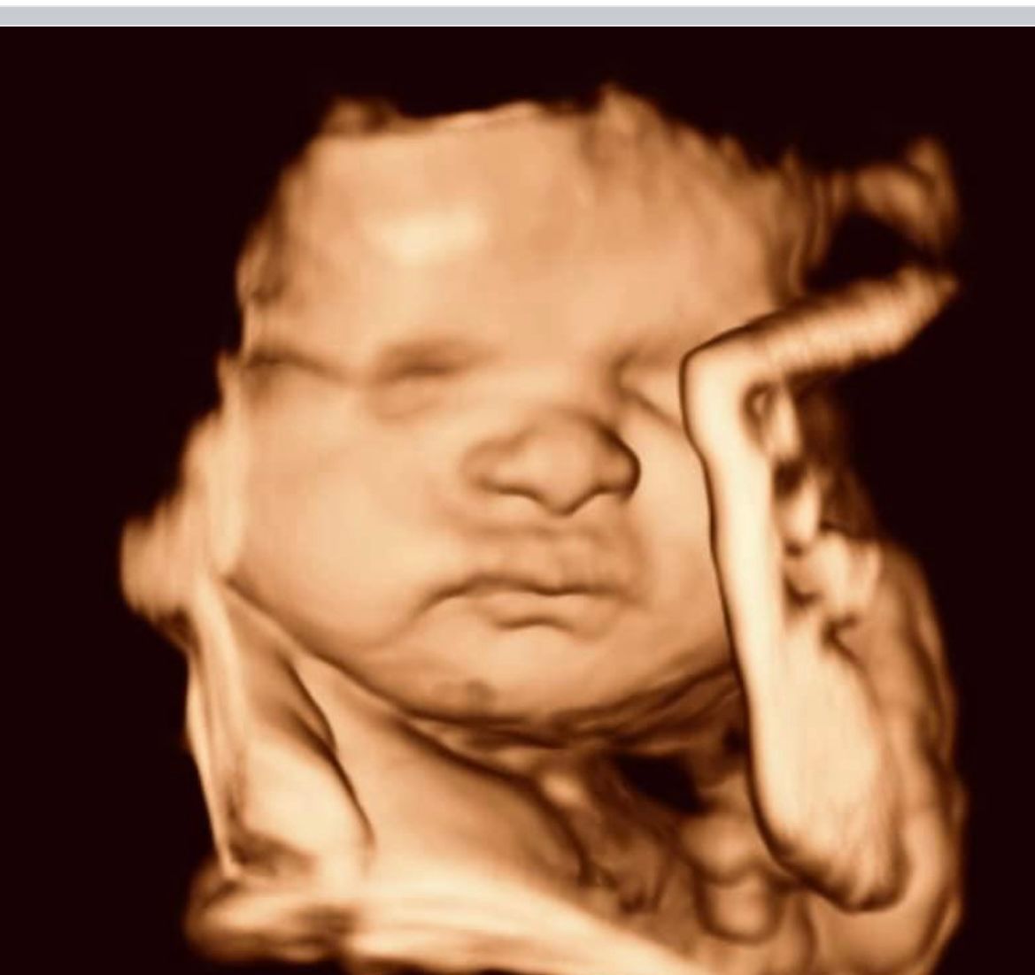 Ultrasound Gallery Greencastle, PA Baby to Be Boutique