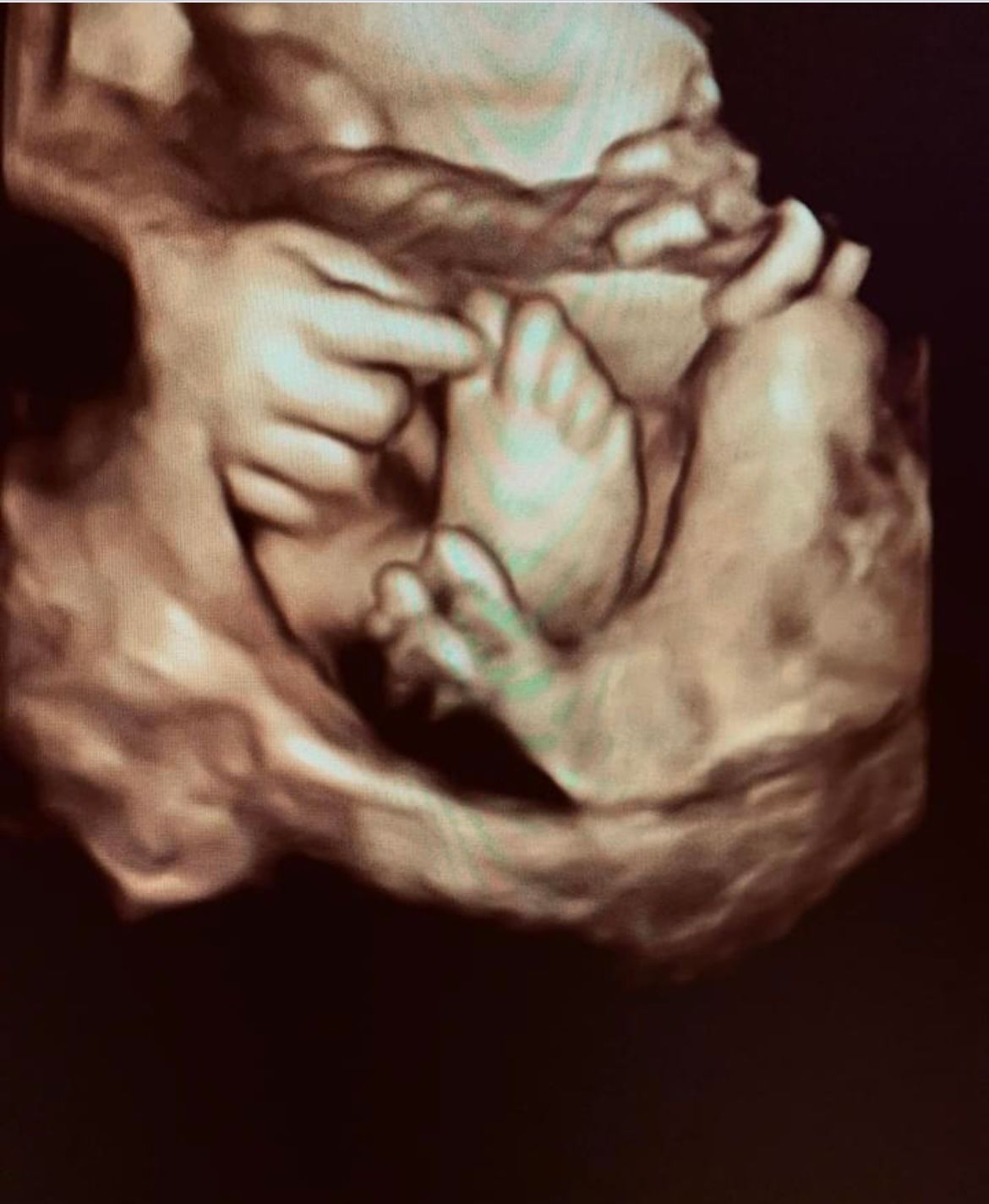 Ultrasound Gallery Greencastle, PA Baby to Be Boutique