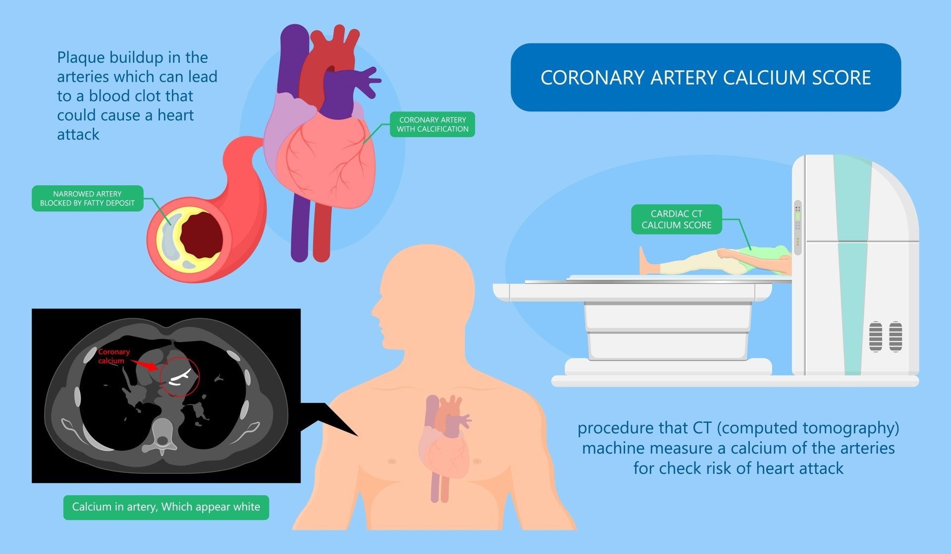 Understanding CARDIAC CT FOR CALCIUM SCORING MRI PLUS
