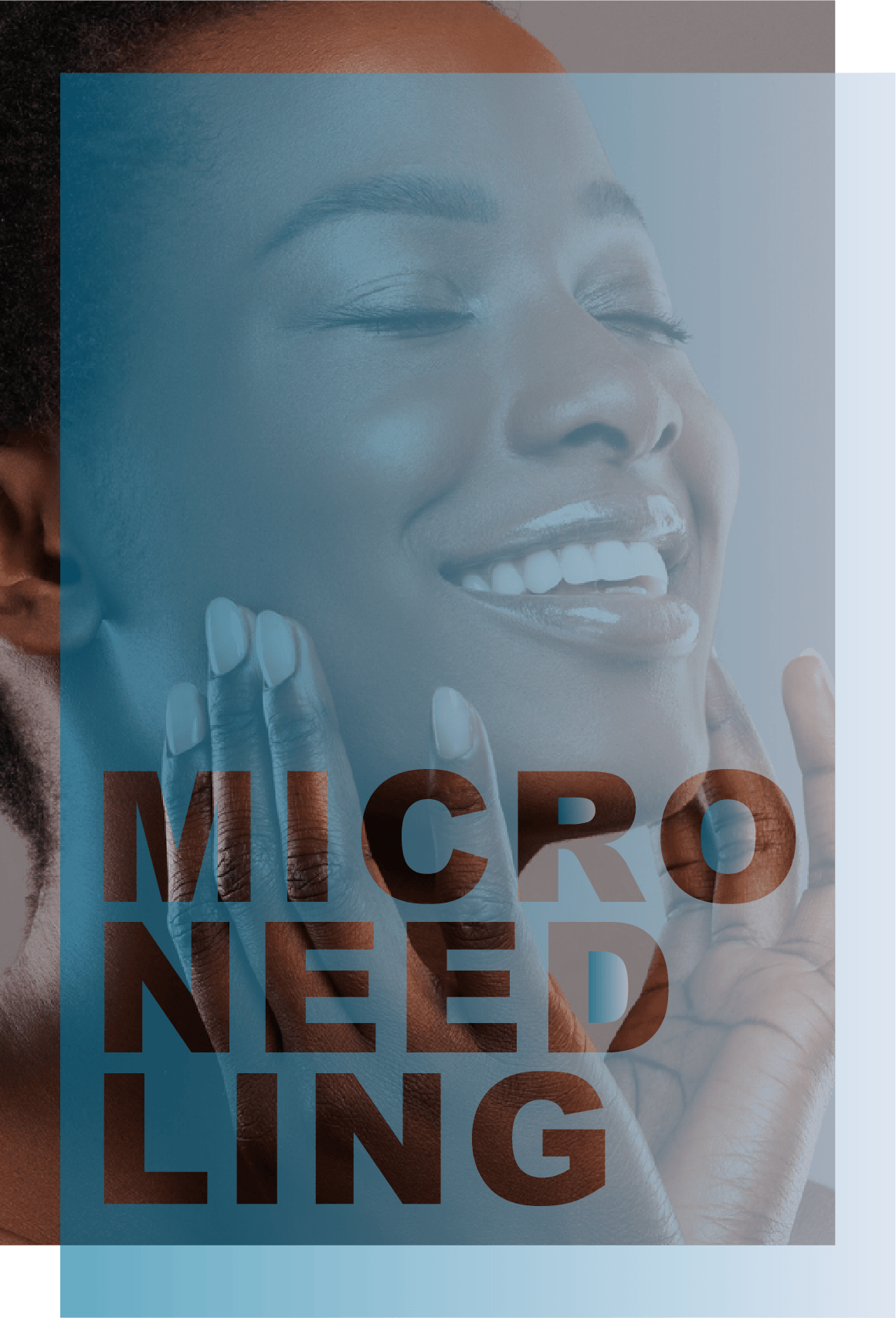Microneedling in Dearborn, Michigan SKIN MD
