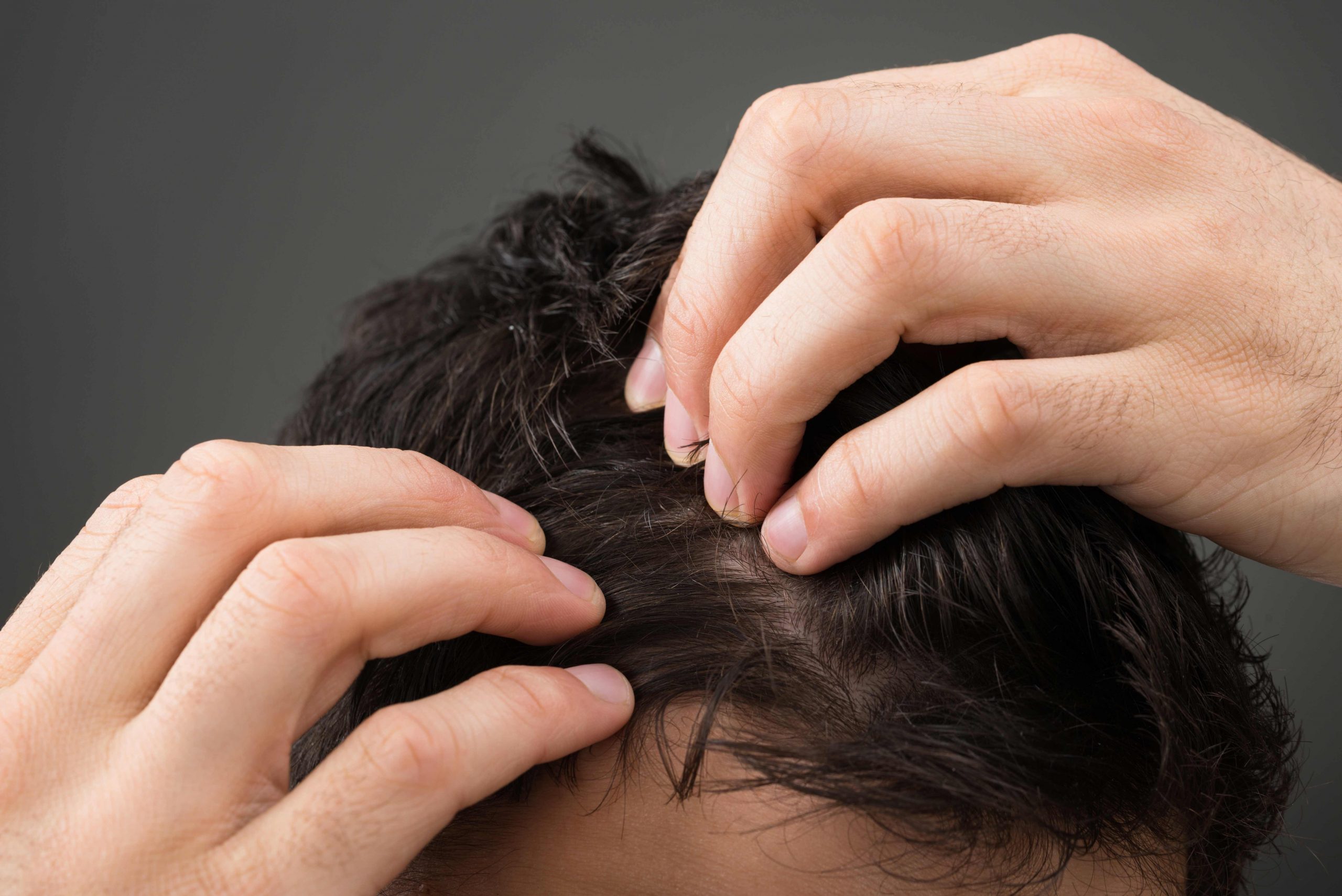 Explore Latest Hair Loss Treatments & Solutions with ISHRS