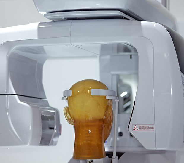 Cone Beam Imaging iSmile Dental Spa Carmichael California