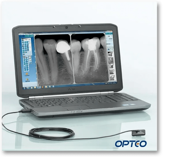 Opteo Dental Digital XRay Sensors (Owandy) California Dental Equipment