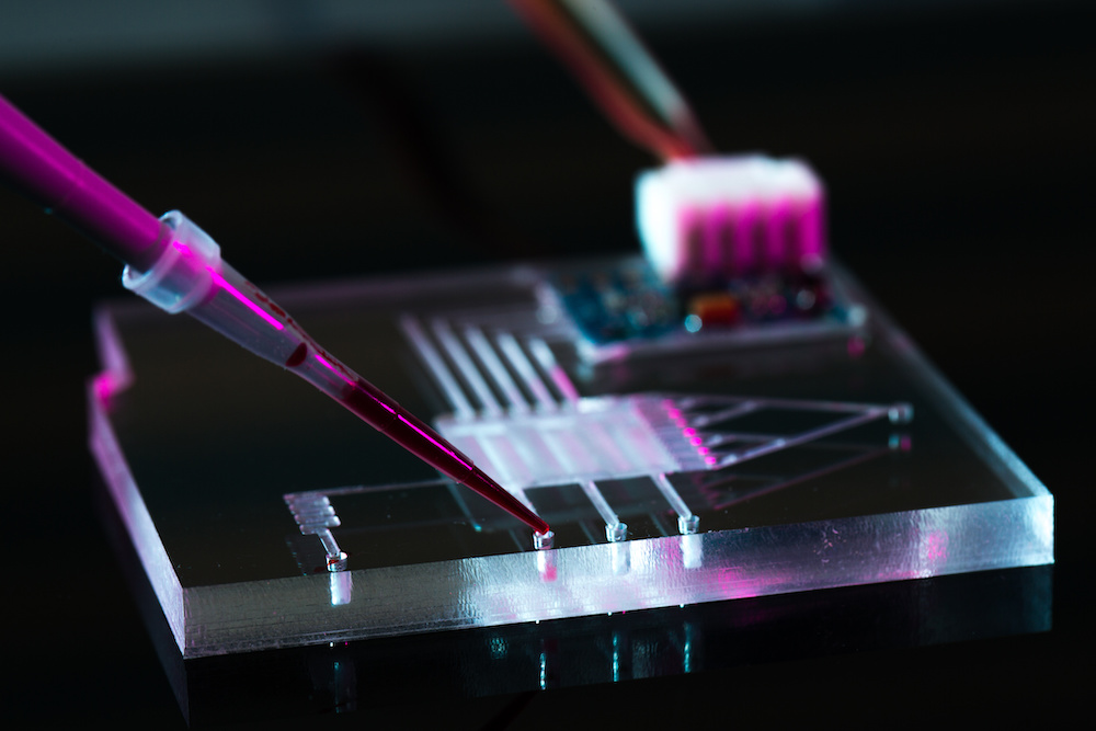 Brain tissue kept alive for weeks with new microfluidic device It Ain