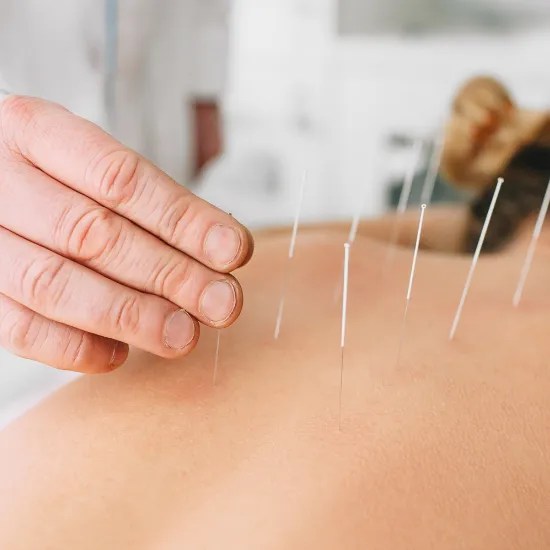 Acupuncture in Manhattan In Touch NYC Physical Therapy