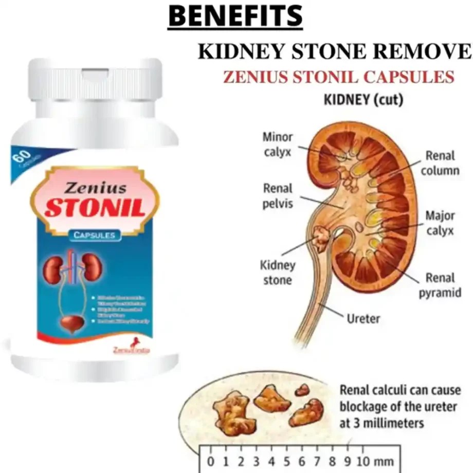 Zenius Stonil Capsule For Kidney Stone Removal Medicine 100gm, 60