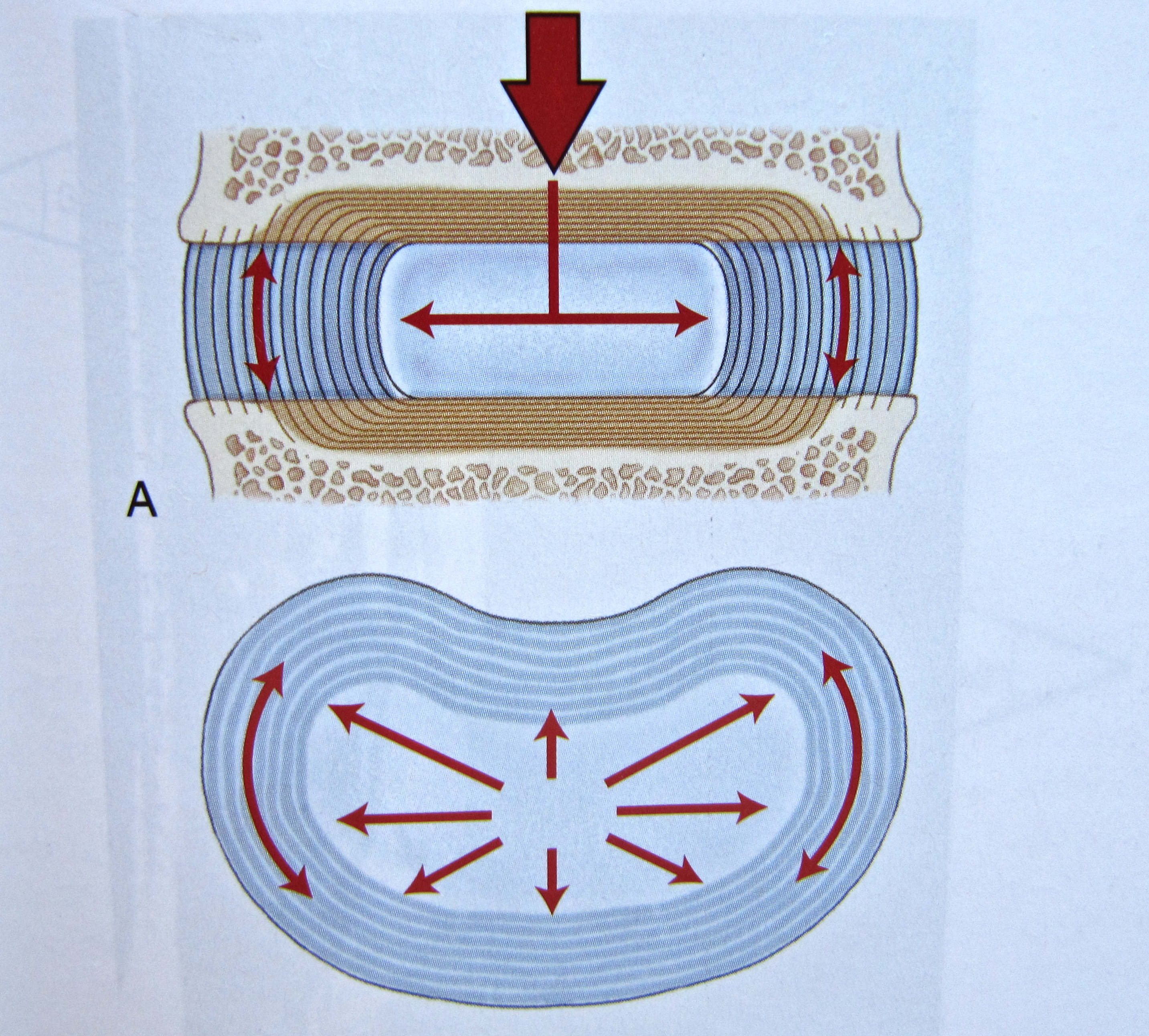 Notes on Anatomy and Physiology The Intervertebral Discs