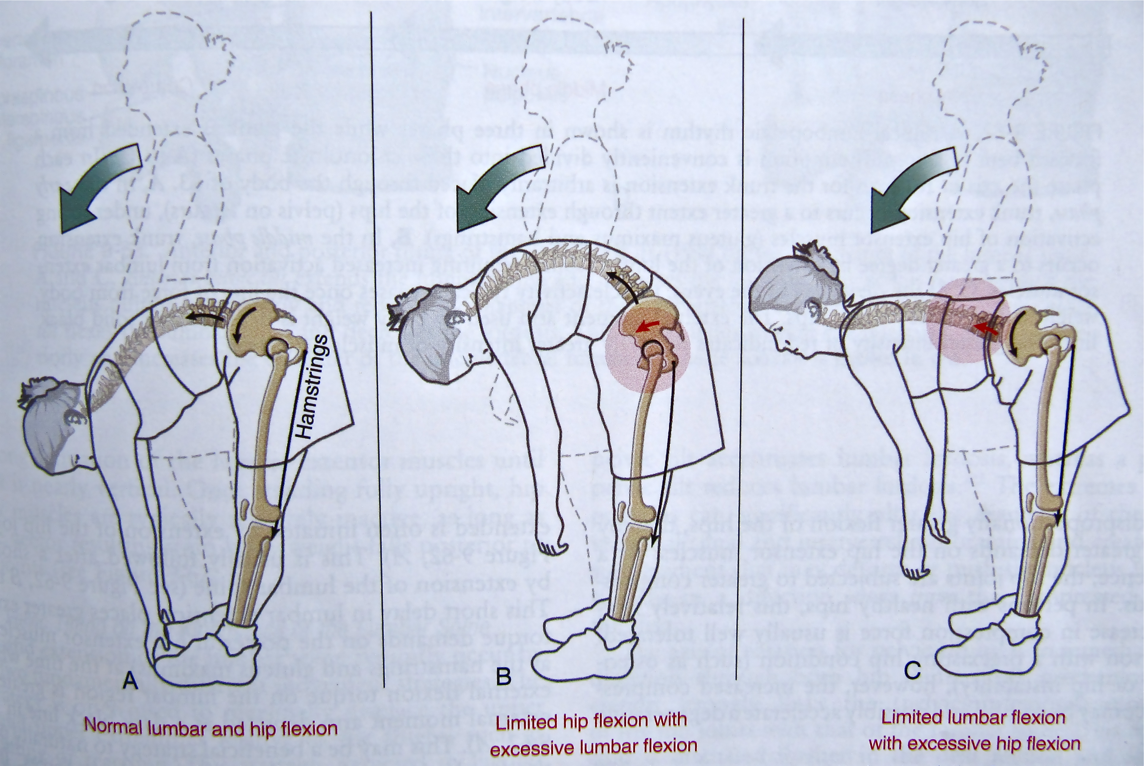 Notes on Anatomy and Physiology Function of the Thoracolumbar Fascia