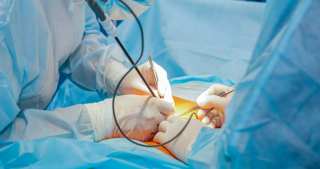 Laparoscopy IVF Canada