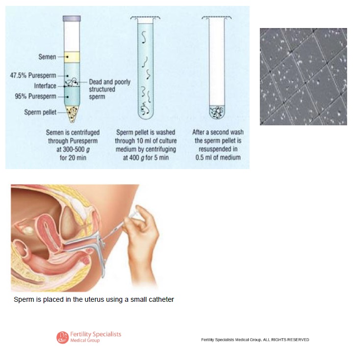 Low Tech Fertility Treatments FSMG San Diego & Carlsbad California