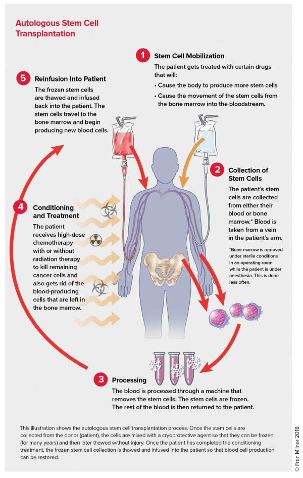 Overview of Treatments for Waldenstrom Macroglobulinemia