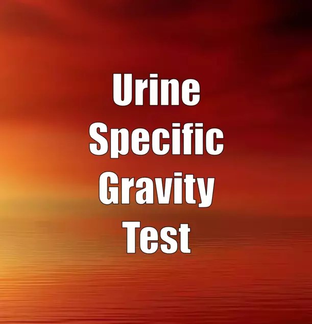 Urine Specific Gravity (SG) Test What You Should Know
