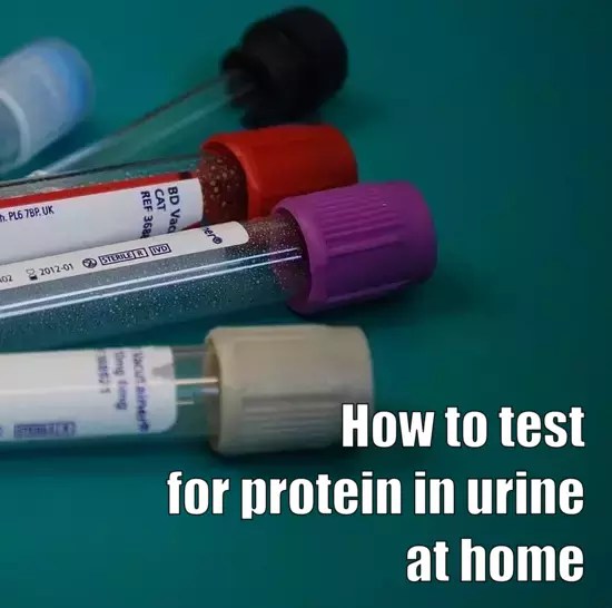 How to Test for Protein in Urine at Home Health Advisor
