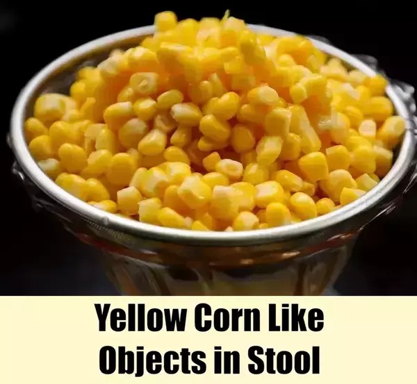 Causes of Yellow Corn Like Objects in Stool Health Advisor