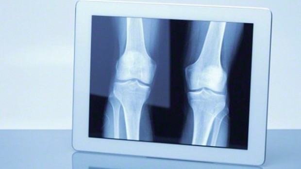 How to Build Bone Mass