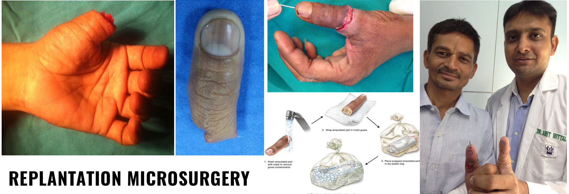 Hand Surgeon Hand Surgery Specialist in Jaipur