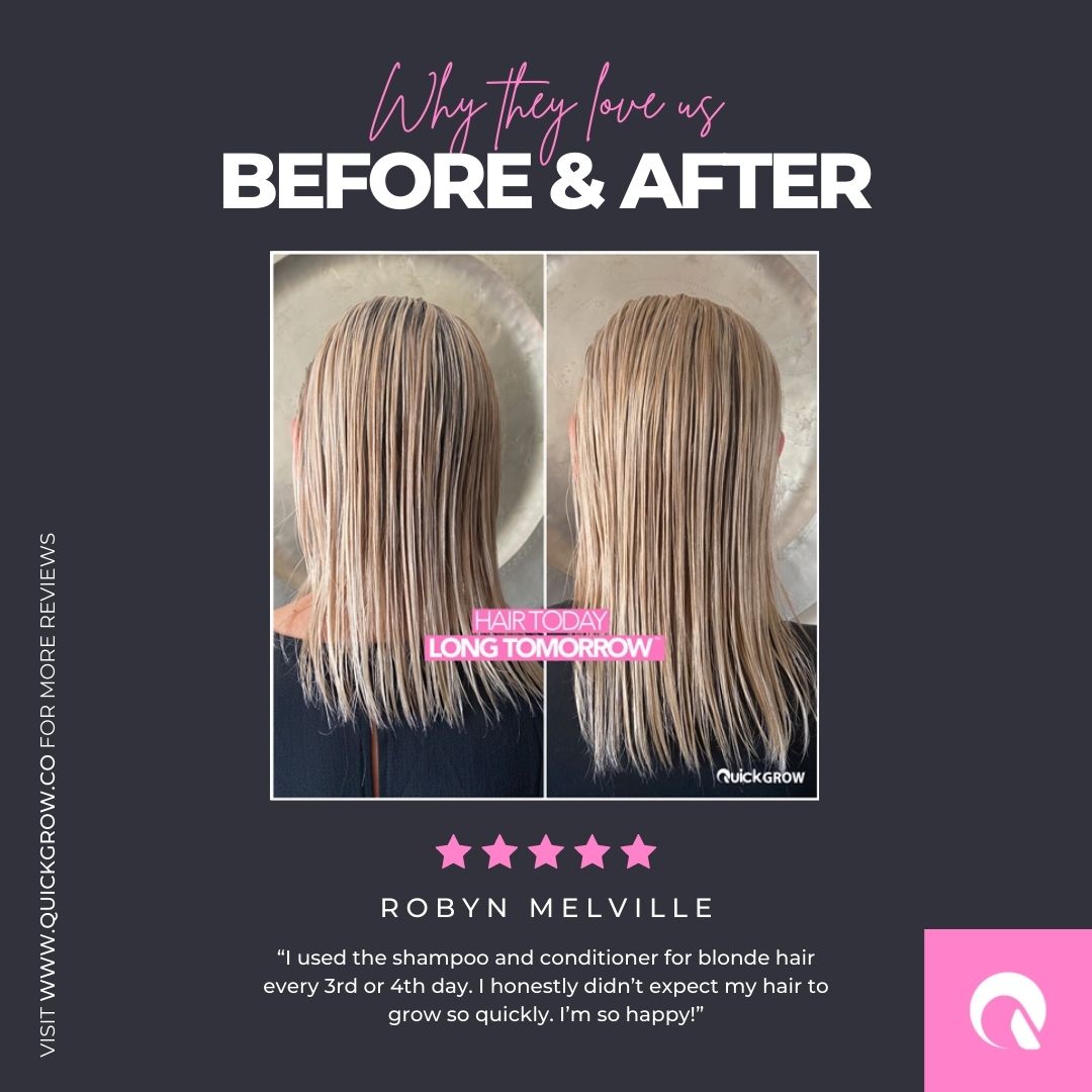 Quick Grow Capsules Jalad Aesthetic Clinic