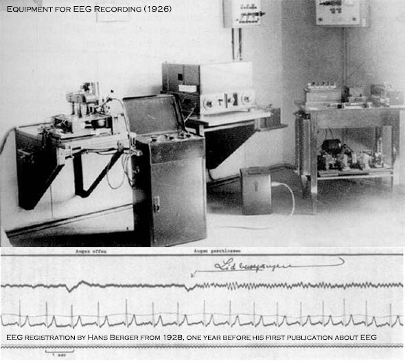 First Eeg Machine