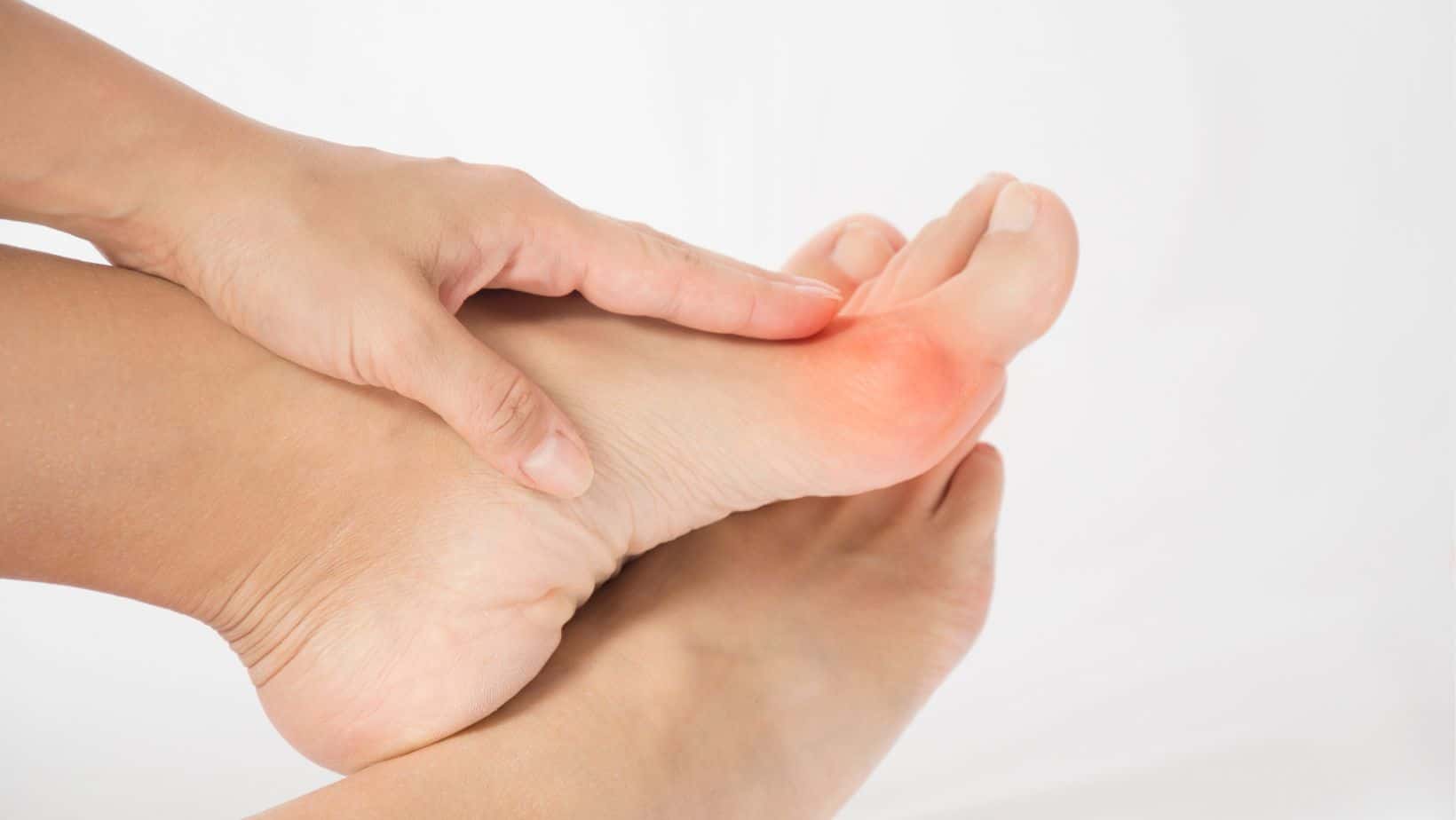 Bunion Pain What causes bunions, diagnosis and Home Treatment