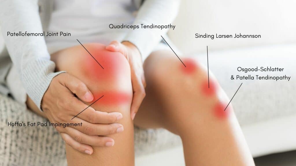 Knee Pain Running Front Knee Pain Running