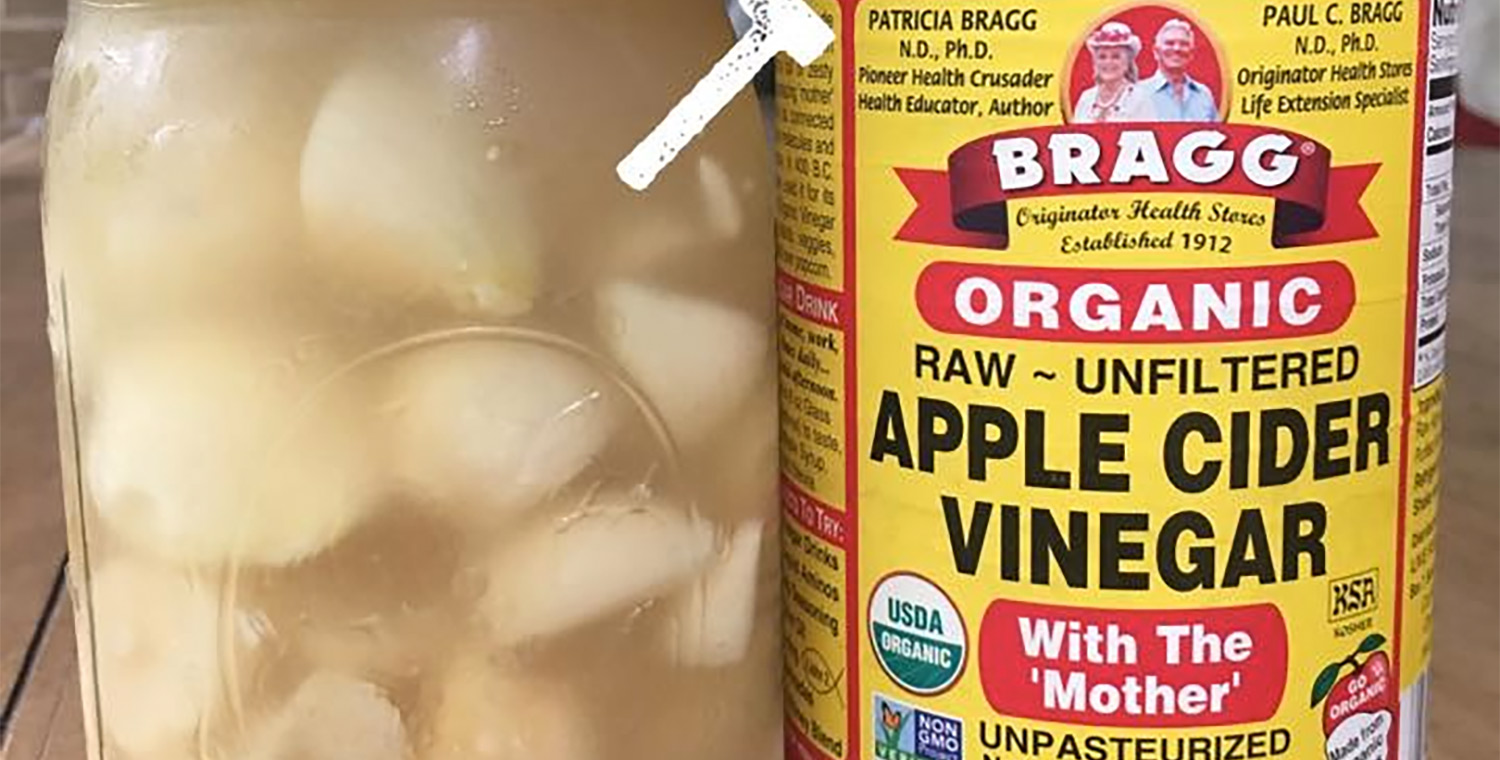 Underground Garlic Heavy Metal GUT Healer Jane Casey's Kitchen