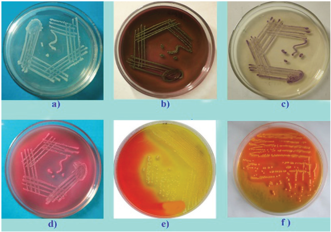 In vitro screening of multidrug resistance uropathogenic Escherichia