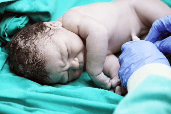 Birth Injury Lawyer The Law Office of Jared S. Zafran The Law