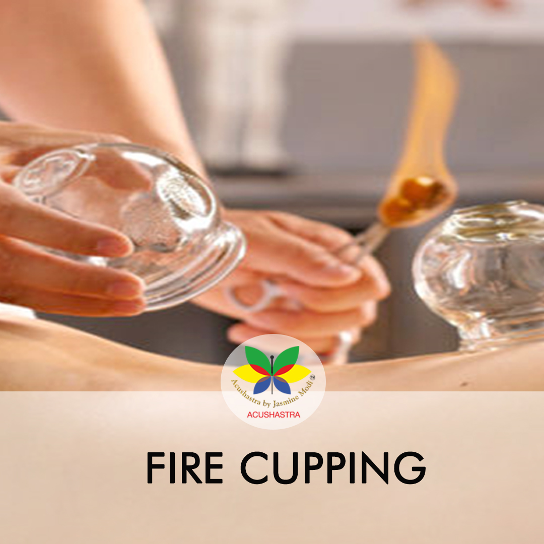 Fire Cupping Jasmine Modi