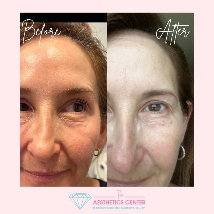 Face and Neck Gallery Jax Aesthetics Center