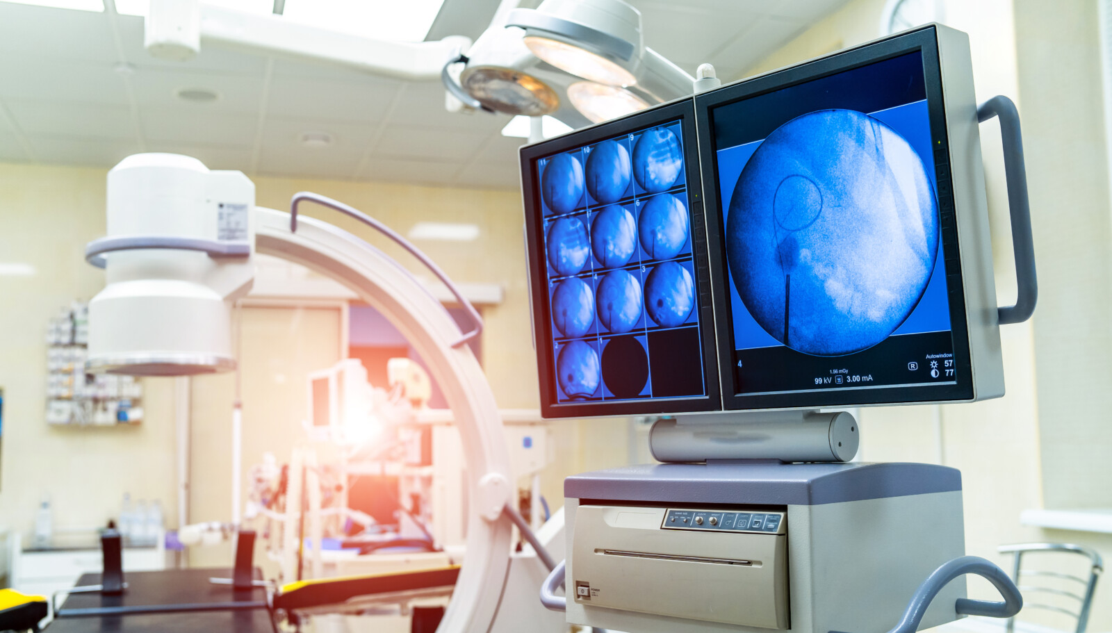 Understanding the Portable XRay Machine Difference Digital XRay Vs