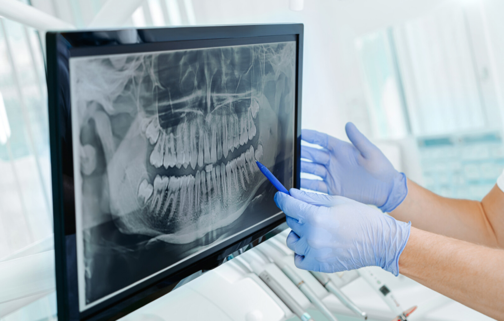 What Are Digital XRays? Are They Safer Than Film XRays?